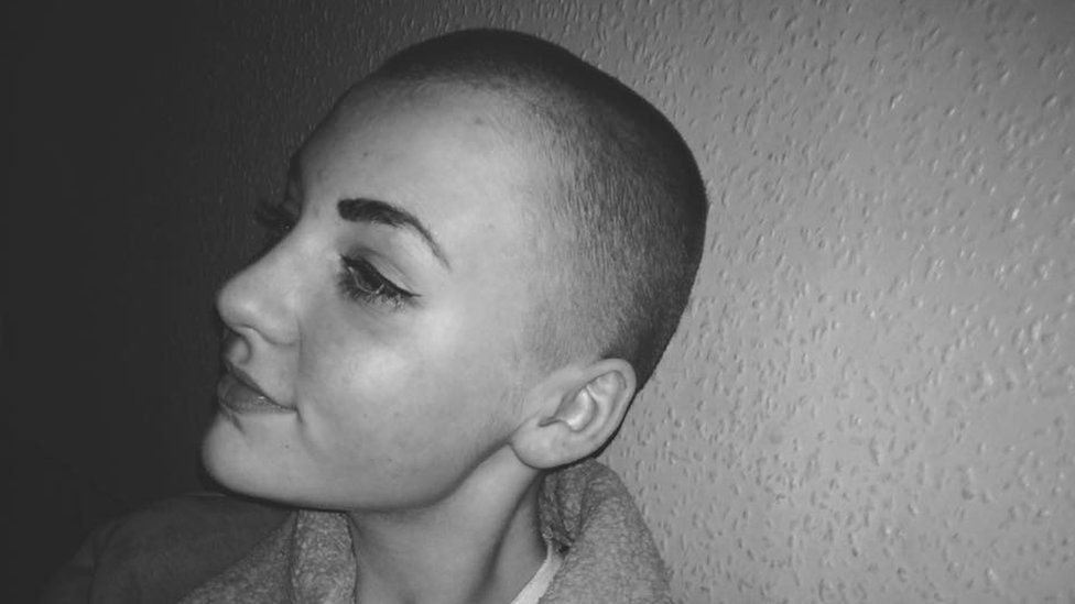 "Kopaszra vágattam a lányom haját, mert kinevette a rákbeteg osztálytársát és letépte a parókáját"